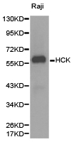 HCK Antibody - Western blot of extracts of Raji cell lines, using HCK antibody.