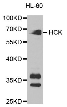 HCK Antibody - Western blot analysis of extracts of HL-60 cell lines.