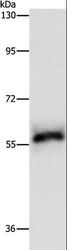 HCK Antibody - Western blot analysis of HeLa cell, using HCK Polyclonal Antibody at dilution of 1:500.