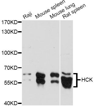 HCK Antibody - Western blot analysis of extracts of various cell lines, using HCK antibody at 1:1000 dilution. The secondary antibody used was an HRP Goat Anti-Rabbit IgG (H+L) at 1:10000 dilution. Lysates were loaded 25ug per lane and 3% nonfat dry milk in TBST was used for blocking. An ECL Kit was used for detection and the exposure time was 90s.