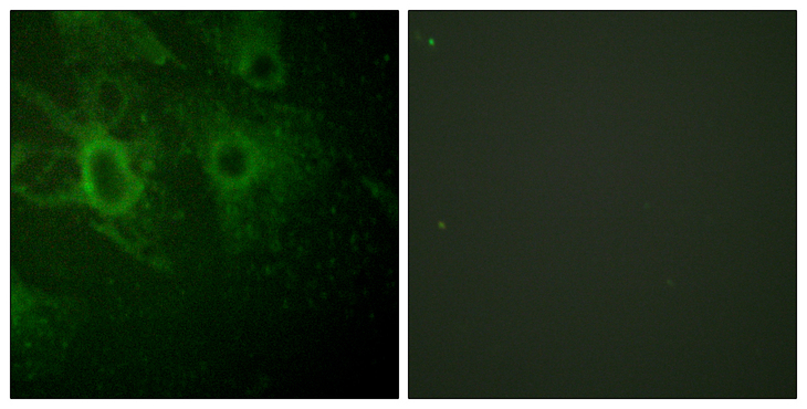 HCK Antibody - Immunofluorescence analysis of HeLa cells, using HCK (Phospho-Tyr410) Antibody. The picture on the right is blocked with the phospho peptide.