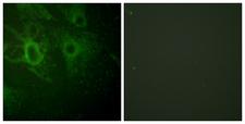 HCK Antibody - P-peptide - + Immunofluorescence analysis of HeLa cells, using HCK (Phospho-Tyr410) antibody.