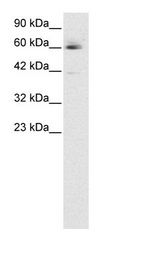 HCLS1 Antibody - Jurkat Cell Lysate.  This image was taken for the unconjugated form of this product. Other forms have not been tested.