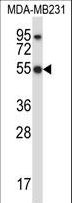 HCLS1 Antibody - HCLS1 Antibody western blot of MDA-MB231 cell line lysates (35 ug/lane). The HCLS1 antibody detected the HCLS1 protein (arrow).