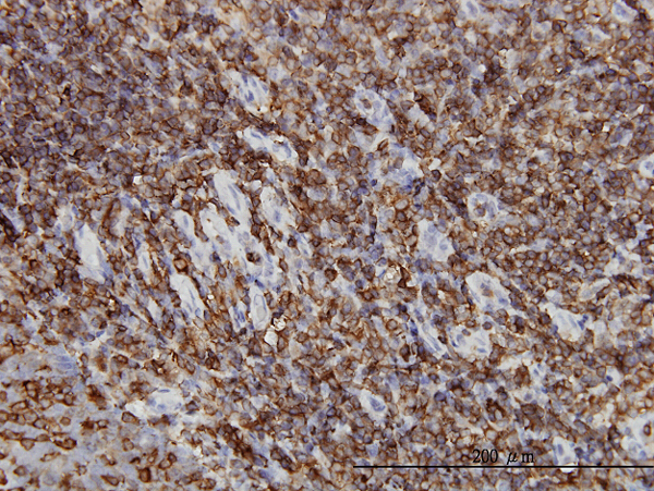 HCLS1 Antibody - Immunoperoxidase of monoclonal antibody to HCLS1 on formalin-fixed paraffin-embedded human tonsil. [antibody concentration 3 ug/ml]