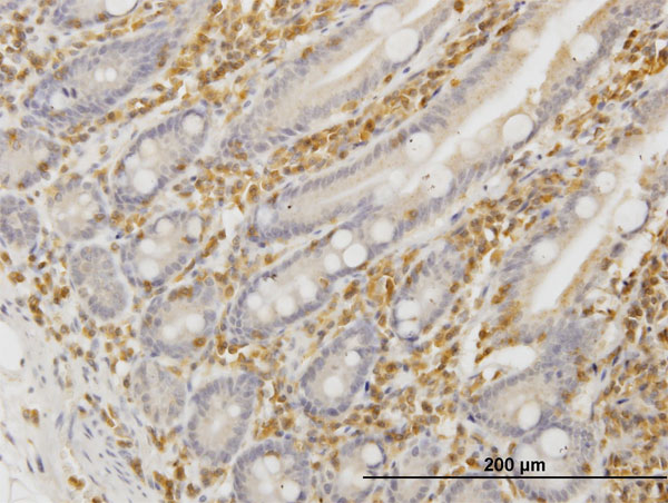 HCLS1 Antibody - Immunoperoxidase of monoclonal antibody to HCLS1 on formalin-fixed paraffin-embedded human small Intestine. [antibody concentration 3 ug/ml]
