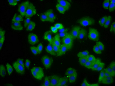 HCN1 Antibody - Immunofluorescence staining of HepG2 cells diluted at 1:166, counter-stained with DAPI. The cells were fixed in 4% formaldehyde, permeabilized using 0.2% Triton X-100 and blocked in 10% normal Goat Serum. The cells were then incubated with the antibody overnight at 4°C.The Secondary antibody was Alexa Fluor 488-congugated AffiniPure Goat Anti-Rabbit IgG (H+L).