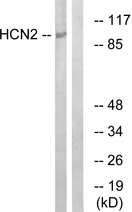 HCN2 Antibody - Western blot analysis of lysates from Jurkat cells, using HCN2 Antibody. The lane on the right is blocked with the synthesized peptide.