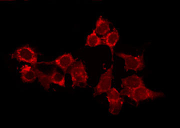 HCN2 Antibody - Staining HeLa cells by IF/ICC. The samples were fixed with PFA and permeabilized in 0.1% Triton X-100, then blocked in 10% serum for 45 min at 25°C. The primary antibody was diluted at 1:200 and incubated with the sample for 1 hour at 37°C. An Alexa Fluor 594 conjugated goat anti-rabbit IgG (H+L) Ab, diluted at 1/600, was used as the secondary antibody.