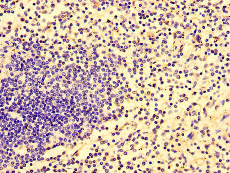 HCP5 Antibody - Immunohistochemistry of paraffin-embedded human spleen tissue using HCP5 Antibody at dilution of 1:100