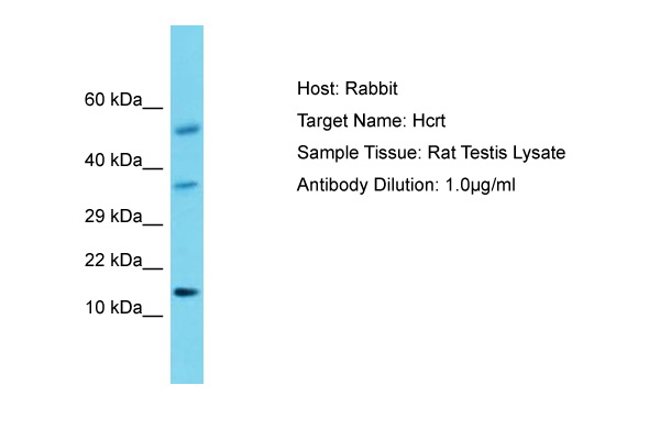 HCRT / Orexin Antibody -  This image was taken for the unconjugated form of this product. Other forms have not been tested.
