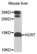 HCRT / Orexin Antibody - Western blot analysis of extracts of mouse liver cells.