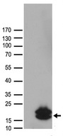 HCRT / Orexin Antibody - HEK293T cells were transfected with the pCMV6-ENTRY control. (Left lane) or pCMV6-ENTRY HCRT. (Right lane) cDNA for 48 hrs and lysed