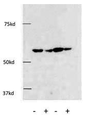 HDAC1 Antibody - The anti-HDAC1 antibody was used in Western Blot to detect HDAC1 in HEK293 cells. Knockdown of HDAC1 using siRNA against HDAC1 showed a significant decrease of HDAC1 protein using this anti-HDAC1 antibody in HEK293 cells.
