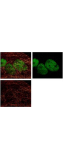 HDAC1 Antibody - Immunofluorescence Microscopy of rabbit anti-HDAC1 Antibody. Tissue: A431 cells. Fixation: methanol. Antigen retrieval: blocked with normal goat serum. Primary antibody: HDAC1 antibody at 04 µg/mL for 1 h at RT. Secondary antibody: rabbit secondary antibody at 0.2 µg/mL for 45 min at RT. Localization: HDAC1 is nuclear. Staining: HDAC1 as green fluorescent signal. A-tubulin monoclonal antibody detected with ATTO 425 (colored RED). 2-color STED image, Leica Microsystems.