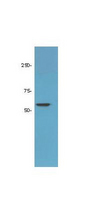 HDAC1 Antibody - Western Blot of rabbit Anti-HDAC-1 Antibody. Lane 1: LNCaP prostate cancer cells. Lane 2: none. Load: 50 µg per lane. Primary antibody: HDAC-1 antibody at 1:1000 for overnight at 4°C. Secondary antibody: rabbit secondary antibody at 1:10,000 for 45 min at RT. Block: 5% BLOTTO overnight at 4°C. Predicted/Observed size: 55kDa for HDAC-1. Other band(s): none.