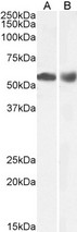 HDAC1 Antibody - Goat Anti-Histone Deacetylase 1 Antibody (0.1µg/ml) staining of Human Duodenum (A) and Lymph Node (B) lysate (35µg protein in RIPA buffer). Primary incubation was 1 hour. Detected by chemiluminescencence.