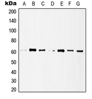 HDAC1 Antibody - Western blot analysis of Histone Deacetylase 1 expression in MCF7 (A); HeLa (B); A431 (C); Jurkat (D); NIH3T3 (E); mouse lung (F); rat heart (G) whole cell lysates.