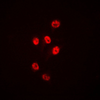 HDAC1 Antibody - Immunofluorescent analysis of Histone Deacetylase 1 staining in HeLa cells. Formalin-fixed cells were permeabilized with 0.1% Triton X-100 in TBS for 5-10 minutes and blocked with 3% BSA-PBS for 30 minutes at room temperature. Cells were probed with the primary antibody in 3% BSA-PBS and incubated overnight at 4 C in a humidified chamber. Cells were washed with PBST and incubated with a DyLight 594-conjugated secondary antibody (red) in PBS at room temperature in the dark. DAPI was used to stain the cell nuclei (blue).