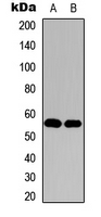 HDAC1 Antibody - Western blot analysis of Histone Deacetylase 1 expression in HeLa (A); NIH3T3 (B) whole cell lysates.