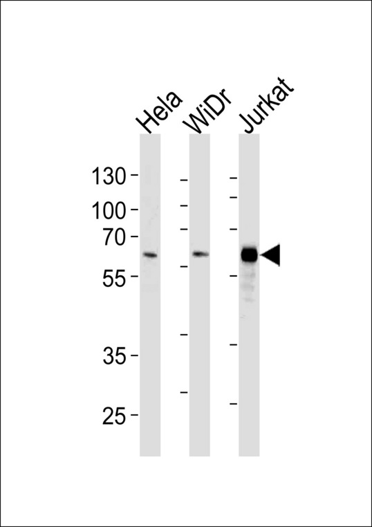 HDAC1 Antibody - HDAC1 Antibody western blot of HeLa,WiDr,Jurkat cell line lysates (35 ug/lane). The HDAC1 antibody detected the HDAC1 protein (arrow).