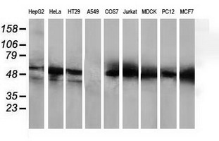 HDAC1 Antibody - Western blot of extracts (35 ug) from 9 different cell lines by using anti-HDAC1 monoclonal antibody.