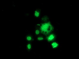 HDAC1 Antibody - Anti-HDAC1 mouse monoclonal antibody immunofluorescent staining of COS7 cells transiently transfected by pCMV6-ENTRY HDAC1.