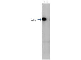 HDAC1 Antibody - Western Blot of Rabbit Anti-HDAC1 antibody. Lane 1: mouse brain extract. Lane 2: mouse brain extract blocked with peptide. Load: 5 ug per lane. Primary antibody: HDAC1 antibody at 1ug/mL for overnight at 4 degrees C. Secondary antibody: IRDye800 alpha rabbit secondary antibody at 1:10,000 for 45 min at RT. Block: 5% BLOTTO overnight at 4 degrees C. Predicted/Observed size: 62 kDa for HDAC1.