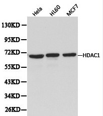 HDAC1 Antibody - Western blot of HDAC1 pAb in extracts from Hela, HL60 and MCF7 cells.
