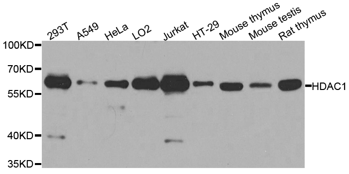 HDAC1 Antibody - Western blot analysis of extracts of various cell lines.