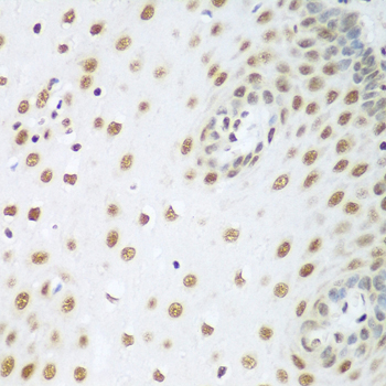 HDAC1 Antibody - Immunohistochemistry of paraffin-embedded human esophagus using HDAC1 antibodyat dilution of 1:100 (40x lens).