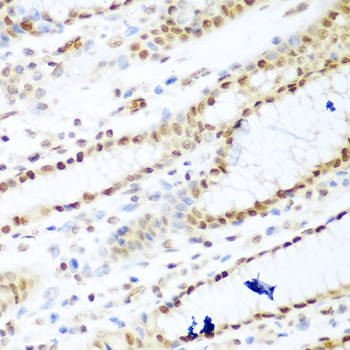 HDAC1 Antibody - Immunohistochemistry of paraffin-embedded human stomach using HDAC1 antibodyat dilution of 1:100 (40x lens).