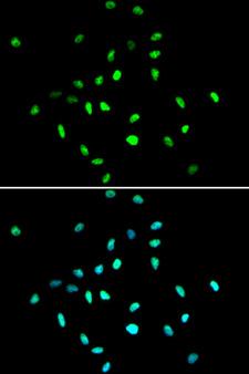 HDAC1 Antibody - Immunofluorescence analysis of A549 cells using HDAC1 antibody. Blue: DAPI for nuclear staining.