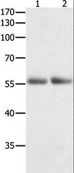 HDAC1 Antibody - Western blot analysis of Human colon and kidney cancer tissue, using HDAC1 Polyclonal Antibody at dilution of 1:400.