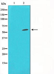 HDAC1 Antibody - Western blot analysis on Jurkat cell lysates using HDAC1 antibody. The lane on the left is treated with the antigen-specific peptide.