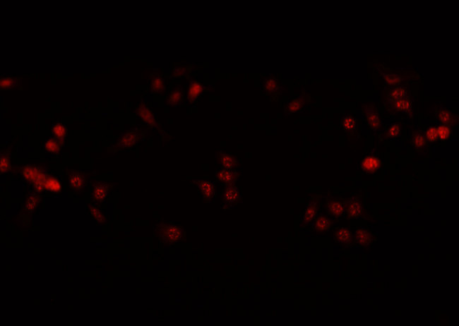 HDAC1 Antibody - Staining A431 cells by IF/ICC. The samples were fixed with PFA and permeabilized in 0.1% Triton X-100, then blocked in 10% serum for 45 min at 25°C. The primary antibody was diluted at 1:200 and incubated with the sample for 1 hour at 37°C. An Alexa Fluor 594 conjugated goat anti-rabbit IgG (H+L) antibody, diluted at 1/600, was used as secondary antibody.