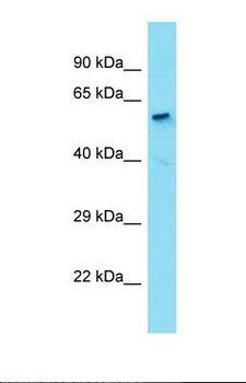 HDAC1 Antibody - Western blot of Human Liver Tumor. HDAC1 antibody dilution 1.0 ug/ml.  This image was taken for the unconjugated form of this product. Other forms have not been tested.