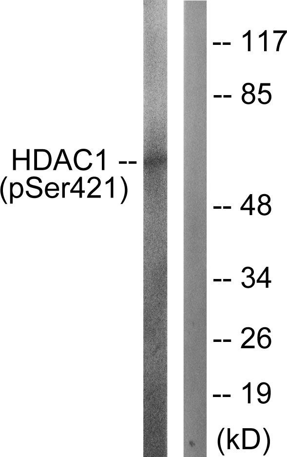 HDAC1 Antibody - Western blot analysis of lysates from Jurkat cells treated with EGF 200ng/ml 30', using HDAC1 (Phospho-Ser421) Antibody. The lane on the right is blocked with the phospho peptide.