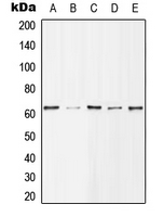 HDAC1 Antibody - Western blot analysis of Histone Deacetylase 1 (pS421) expression in MCF7 EGF-treated (A); Jurkat (B); NIH3T3 (C); mouse spleen (D); H9C2 EGF-treated (E) whole cell lysates.