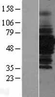 HDAC1 Protein - Western validation with an anti-DDK antibody * L: Control HEK293 lysate R: Over-expression lysate