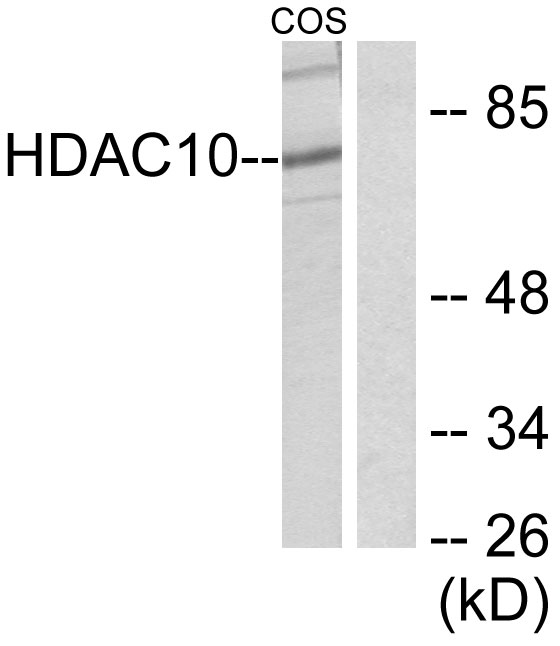 HDAC10 Antibody - Western blot analysis of lysates from COS7 cells, using HDAC10 Antibody. The lane on the right is blocked with the synthesized peptide.