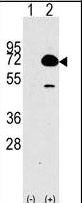 HDAC10 Antibody - Western blot of HDAC10 (arrow) using rabbit polyclonal HDAC10 Antibody (RB02583). 293 cell lysates (2 ug/lane) either nontransfected (Lane 1) or transiently transfected with the HDAC10 gene (Lane 2) (Origene Technologies).