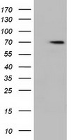 HDAC10 Antibody - HEK293T cells were transfected with the pCMV6-ENTRY control (Left lane) or pCMV6-ENTRY HDAC10 (Right lane) cDNA for 48 hrs and lysed. Equivalent amounts of cell lysates (5 ug per lane) were separated by SDS-PAGE and immunoblotted with anti-HDAC10.