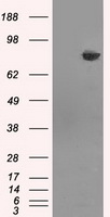 HDAC10 Antibody - HEK293T cells were transfected with the pCMV6-ENTRY control (Left lane) or pCMV6-ENTRY HDAC10 (Right lane) cDNA for 48 hrs and lysed. Equivalent amounts of cell lysates (5 ug per lane) were separated by SDS-PAGE and immunoblotted with anti-HDAC10.