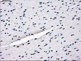 HDAC10 Antibody - Immunohistochemical staining of paraffin-embedded colon tissue using anti-HDAC10 mouse monoclonal antibody. (Dilution 1:50).