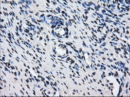 HDAC10 Antibody - Immunohistochemical staining of paraffin-embedded Ovary tissue using anti-HDAC10 mouse monoclonal antibody. (Dilution 1:50).