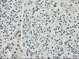 HDAC10 Antibody - Immunohistochemical staining of paraffin-embedded endometrium tissue using anti-HDAC10 mouse monoclonal antibody. (Dilution 1:50).