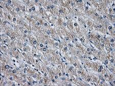HDAC10 Antibody - Immunohistochemical staining of paraffin-embedded liver tissue using anti-HDAC10 mouse monoclonal antibody. (Dilution 1:50).