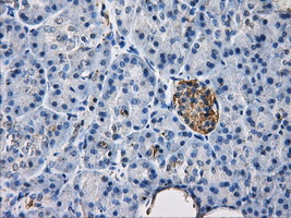 HDAC10 Antibody - Immunohistochemical staining of paraffin-embedded pancreas tissue using anti-HDAC10 mouse monoclonal antibody. (Dilution 1:50).