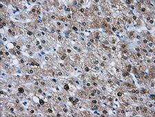 HDAC10 Antibody - IHC of paraffin-embedded liver tissue using anti-HDAC10 mouse monoclonal antibody. (Dilution 1:50).